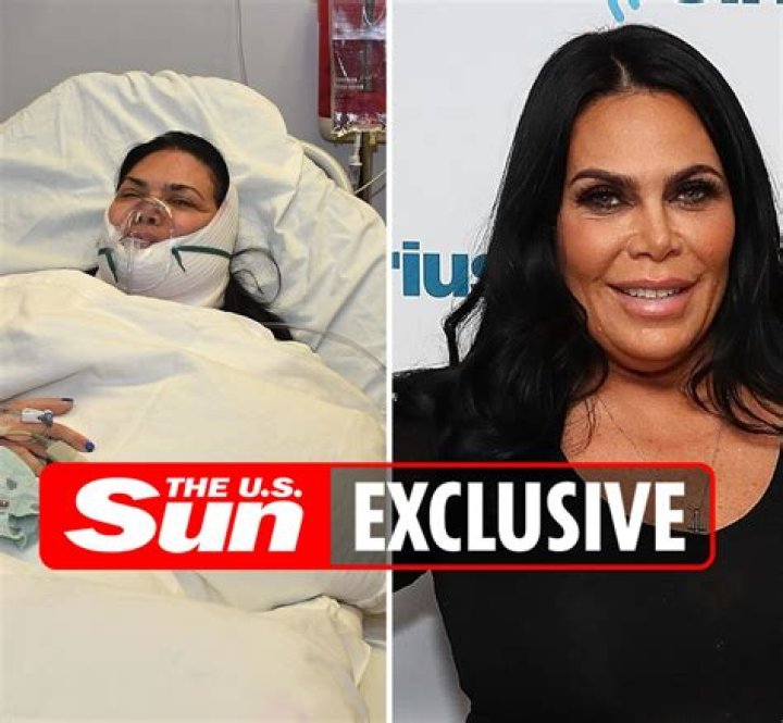 'Mob Wives' Star Renee Graziano: 'I Wake Up Every Day In Pain' After Almost Dying In Surgery