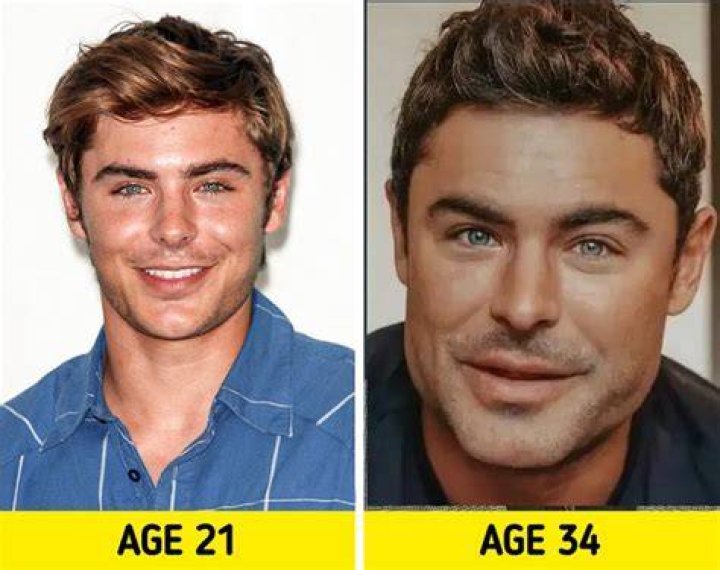 Before & After Face Photos – Hollywood Life