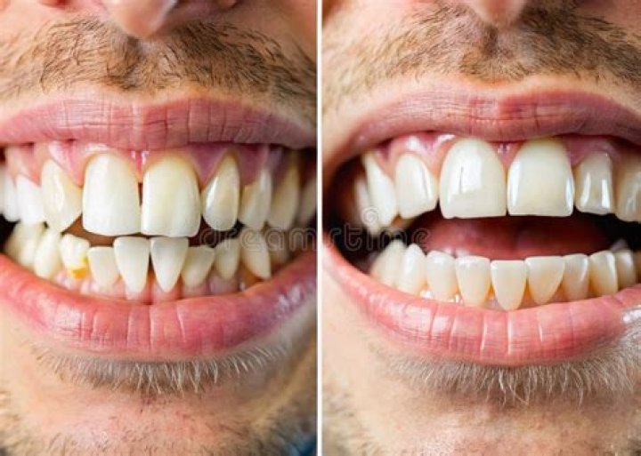 before-and-after
