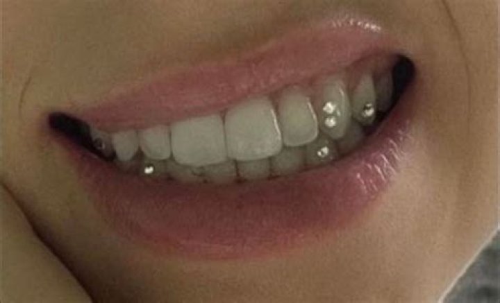 billie eilish tooth gems