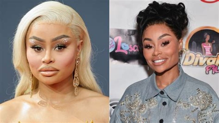 Blac Chyna Lost 10 Pounds After Having Silicone Removed From Her Butt – Hollywood Life