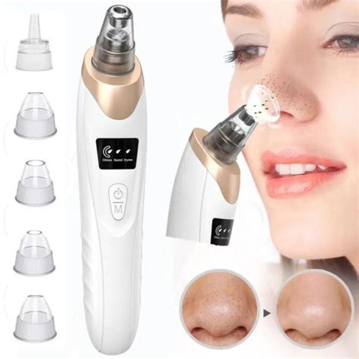 blackhead remover