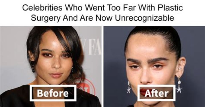Cardi B Slams Fan Over Gym Video After Getting Plastic Surgery – Hollywood Life