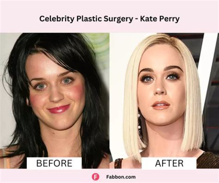 Celebrities Before After Plastic Surgery Photos