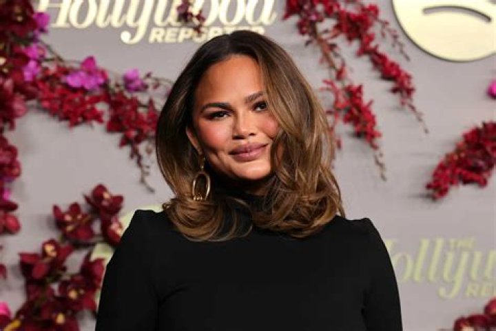 Chrissy Teigen Flaunts ‘Freaky’ Skin-Implanted Feathers & Fans Freak On Twitter — Pics