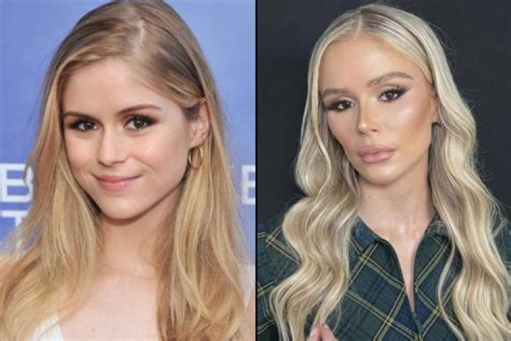 Did She Get Plastic Surgery? Expert Speaks – Hollywood Life