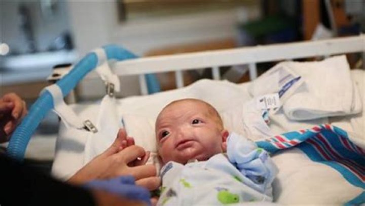 Eli Thompson: Meet The Very Cute Baby Who Was Born Without A Nose