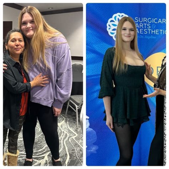 GG Gharachedaghi Reveals 28 Lb. Weight Loss From Ozempic: ‘More’ Than I ‘Anticipated’