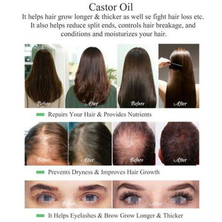 Highest-Rated Castor Oil of 2023 – Hollywood Life Reviews – Hollywood Life