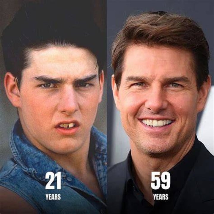 His Then And Now Transformation Photos – Hollywood Life