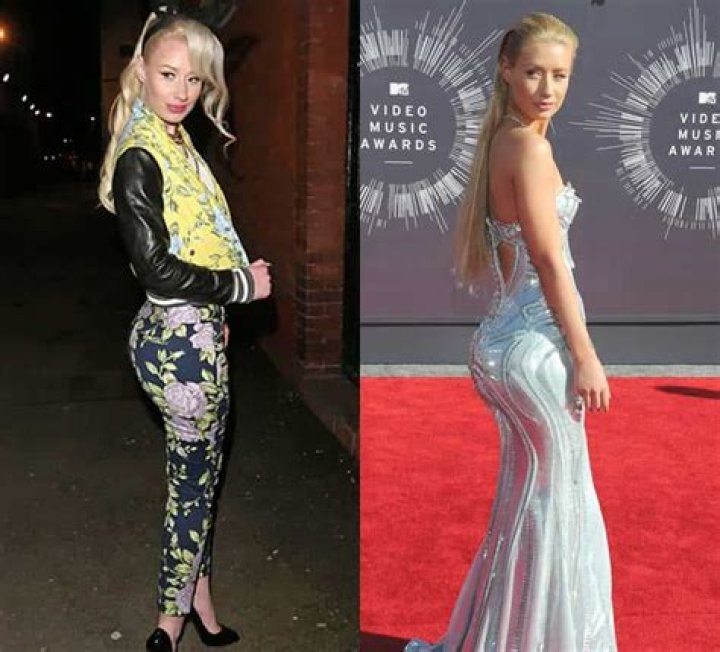 Iggy Azalea Brazilian Butt Lift