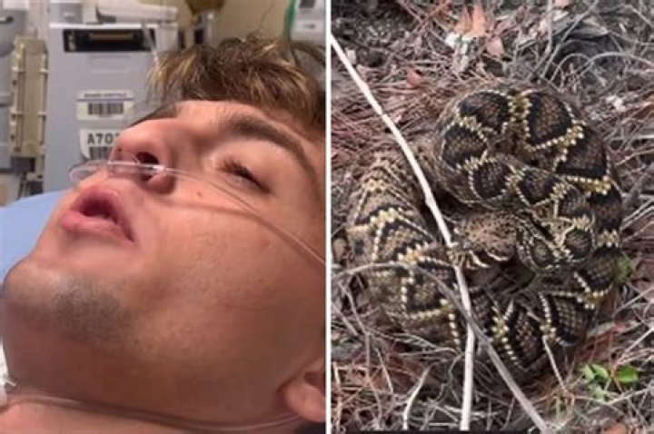 Jon Gosselin Is Hospitalized After Being Bit By Venomous Spider: ‘I Was In Excruciating Pain’