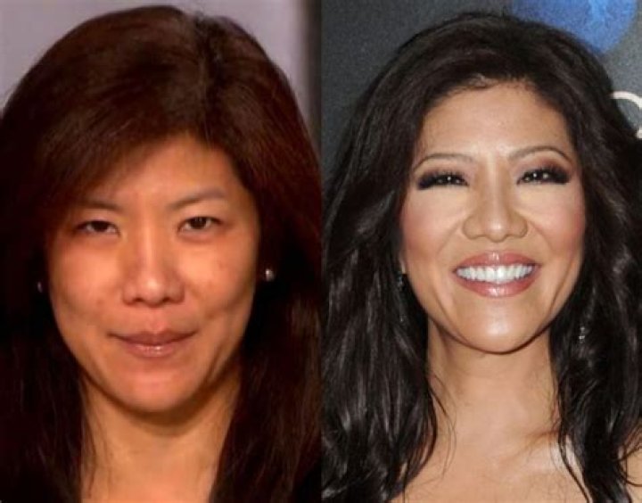 Julie Chen Plastic Surgery