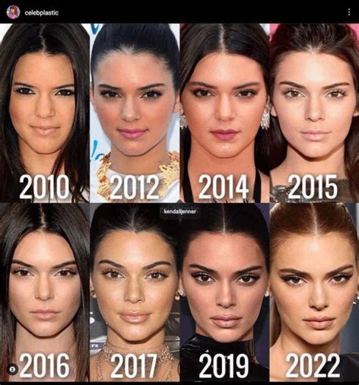 Kendall Jenner Doesn’t Travel Without Her Favorite Lip Balm
