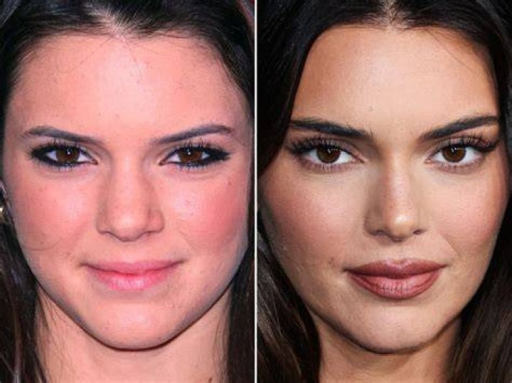 Kendall Jenner In Greece
