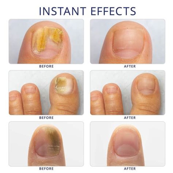 Keratin-Infused Nail Treatment Will Revive Damaged Nails – Hollywood Life