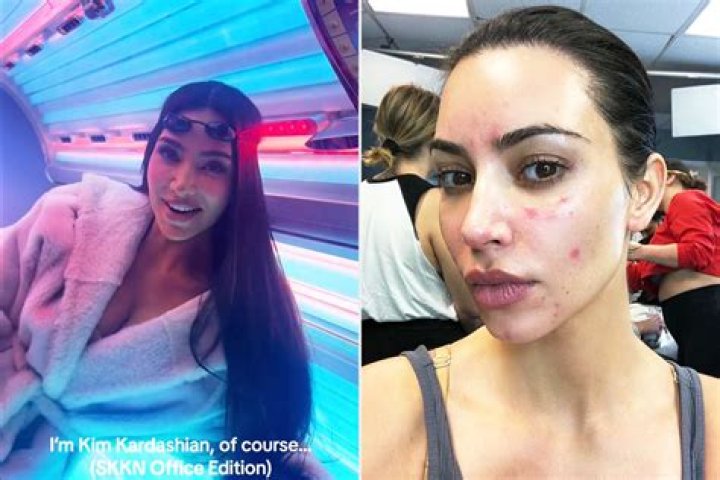 Kim Kardashian Admits Using a Tanning Bed ‘Really Helps’ With Her Psoriasis Amid Controversy