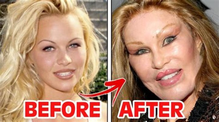 Linda Evangelista, 56, Seen Bare-Faced For 1st Time Since Revealing Botched Cosmetic Procedure