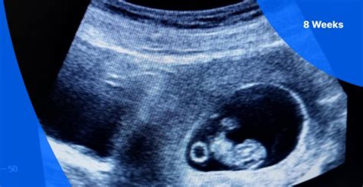 New Baby Ultrasound May Show Something’s Wrong – Hollywood Life