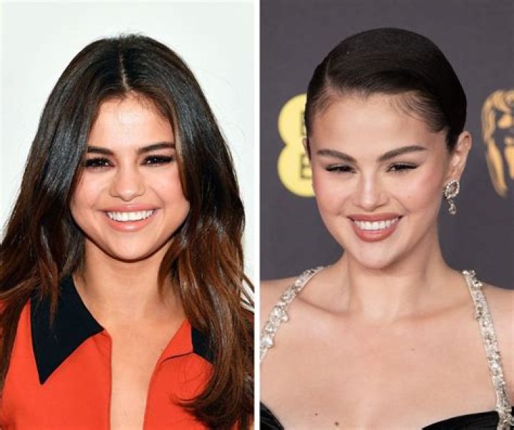Nick Jonas Raves Over Ex Selena Gomez: She’s So ‘Incredibly Smart’