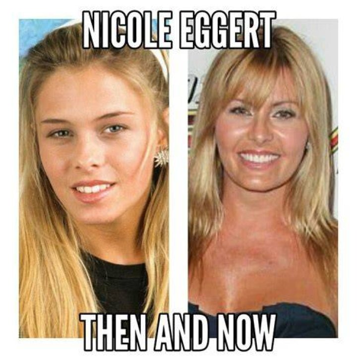 Nicole Eggert Then & Now: See Photos Of &lsquo;Baywatch&rsquo; Star Today
