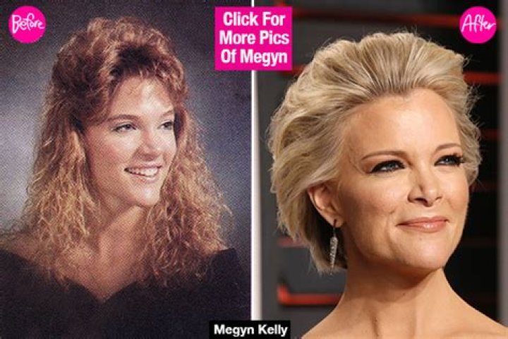 [PICS] Megyn Kelly Nose Job — Did She Get Plastic Surgery? See Photos – Hollywood Life