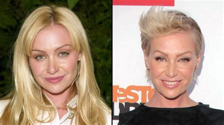 Portia De Rossi Plastic Surgery Before After