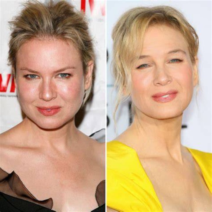 Renee Zellweger: Through The Years