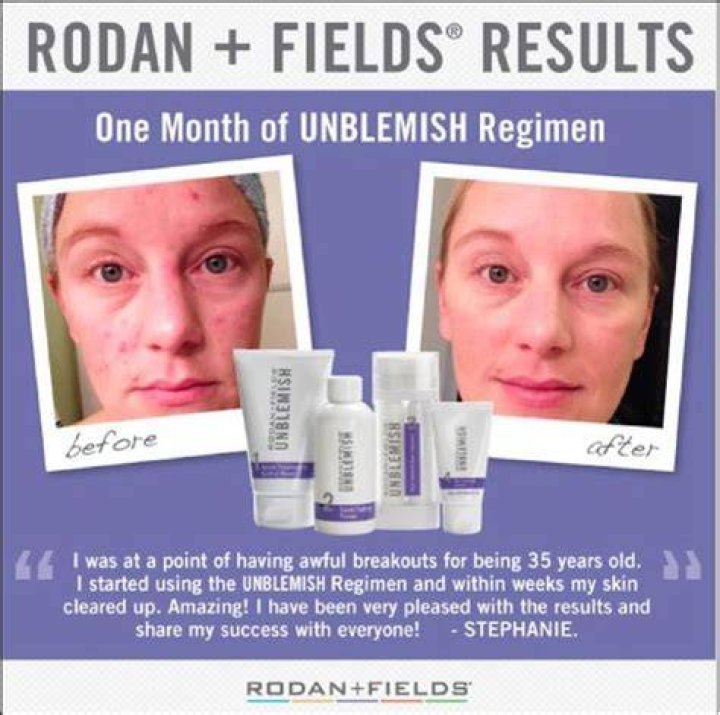 Rodan + Fields Unblemish Regimen, $186, rodanandfields.com