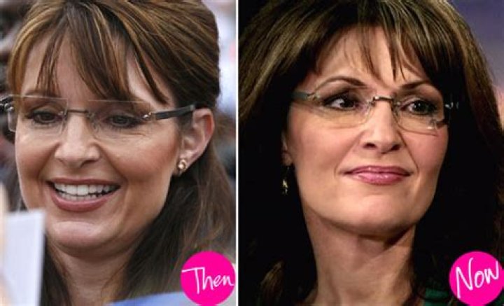 Sarah Palin Plastic Surgery — Did She or Didn't She? – Hollywood Life