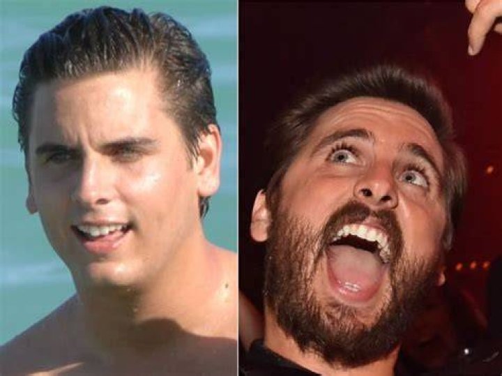 Scott Disick ‘Embarrassed’ & ‘Mad’ After Younes Bendjima Shares Their Private DMs: He May Clap Back