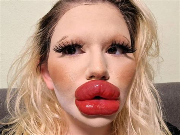 See Her Throwback Pic Before Plump Lips – Hollywood Life