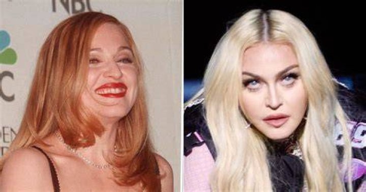See Photos Of Talented Singer’s Transformation – Hollywood Life