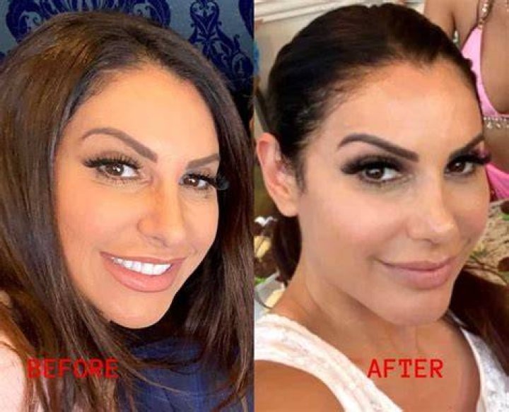 See ‘RHONJ’ Star’s Before & After Pics – Hollywood Life