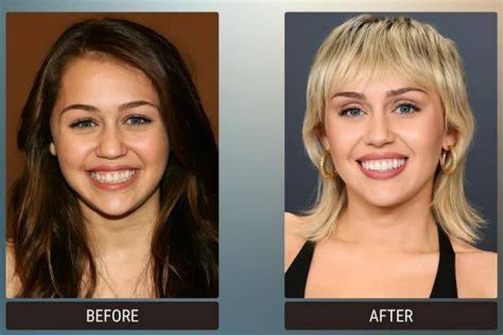See The NBA Star’s Before & After Look – Hollywood Life