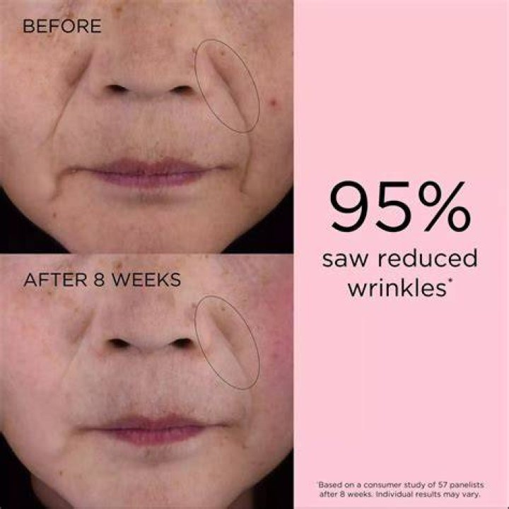 Smooth, Wrinkle-Free Skin Is Possible With These Gentle Yet Effective Retinol Serums