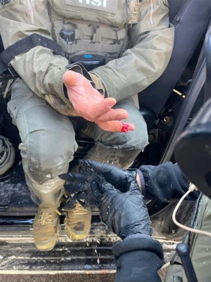 ‘Storage Wars’ Star Dan Dotson Has Finger Bitten Off By His French Bulldog