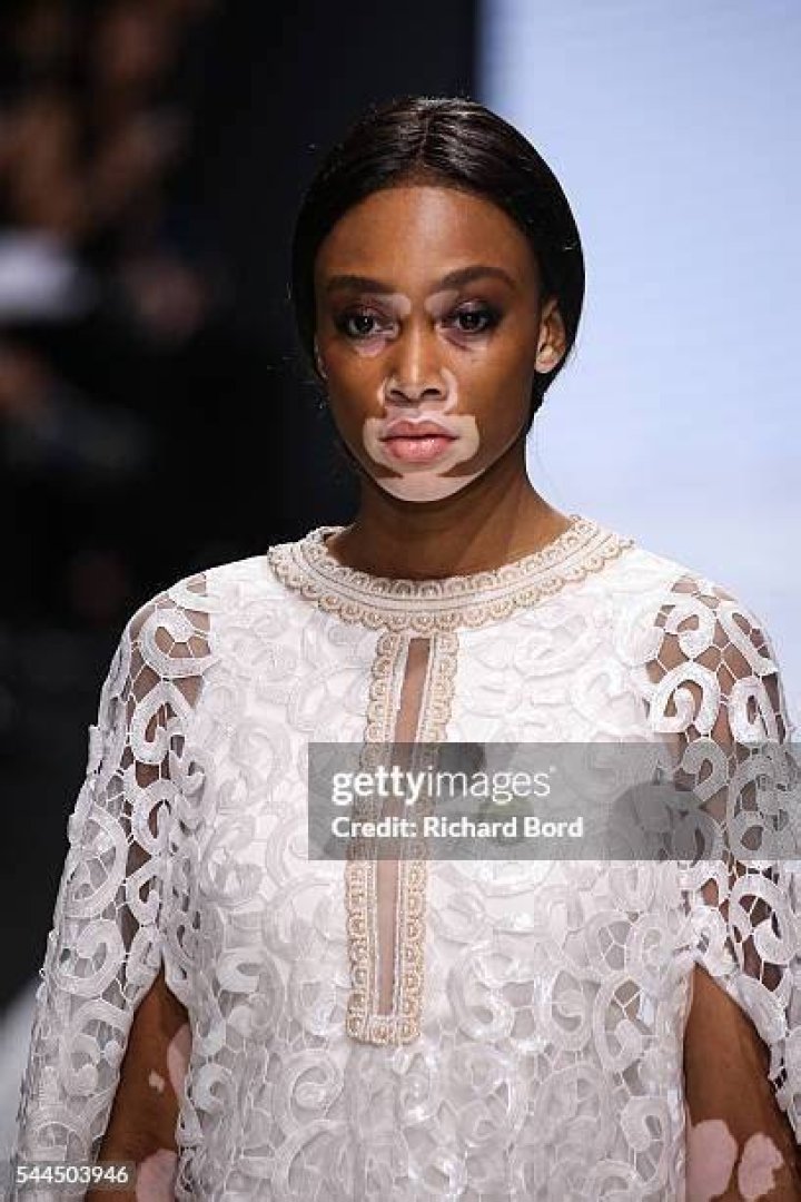 Winnie Harlow &mdash; 2016