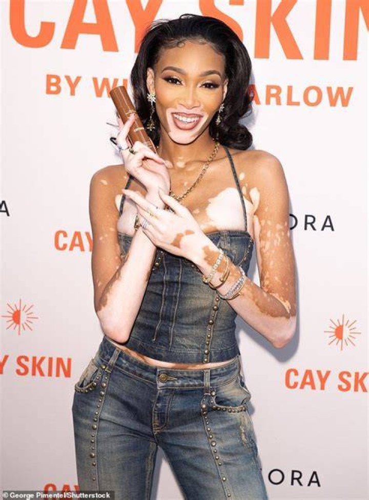Winnie Harlow&rsquo;s Cay Skin